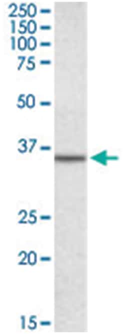 ANXA2, Goat, Polyclonal Antibody, Abnova 100&mu;g; Unlabeled:Antikroppar