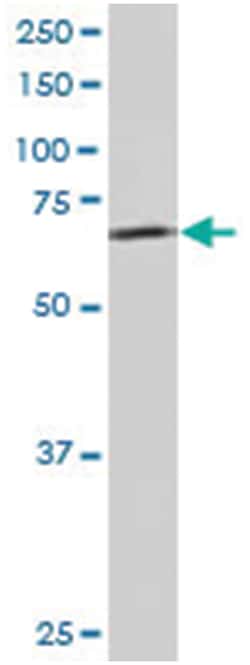 TBL1X/TBL1XR1, Goat, Polyclonal Antibody, Abnova 100 &mu;g | Buy Online | Abnova Corporation | Fisher Scientific