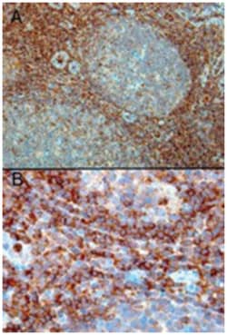 RAC2, Goat, Polyclonal Antibody, Abnova 100 &mu;g | Buy Online | Abnova Corporation | Fisher Scientific