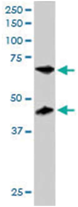 TERF1, Goat, Polyclonal Antibody, Abnova 100 &mu;g | Buy Online | Abnova Corporation | Fisher Scientific