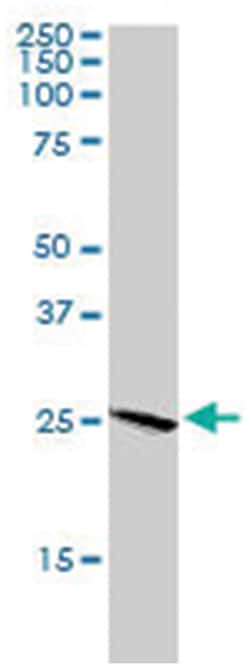 BAK1, Goat, Polyclonal Antibody, Abnova 100 &mu;g | Buy Online | Abnova Corporation | Fisher Scientific
