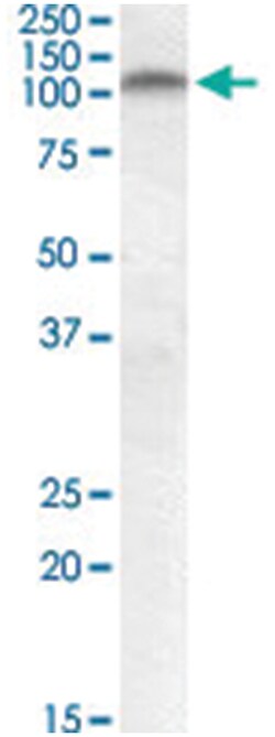 PLK4, Goat, Polyclonal Antibody, Abnova 100 &mu;g | Buy Online | Abnova Corporation | Fisher Scientific