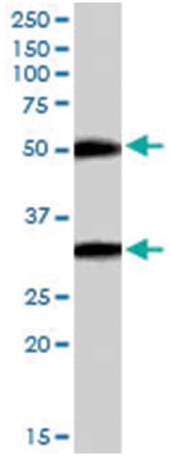 TMPRSS5, Goat, Polyclonal Antibody, Abnova 100 &mu;g | Buy Online | Abnova Corporation | Fisher Scientific