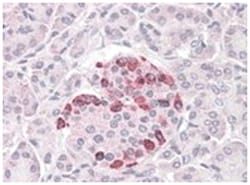 SOCS4, Goat, Polyclonal Antibody, Abnova 100 &mu;g | Buy Online | Abnova Corporation | Fisher Scientific