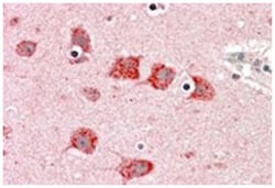 DKK3, Goat, Polyclonal Antibody, Abnova 100 &mu;g | Buy Online | Abnova Corporation | Fisher Scientific