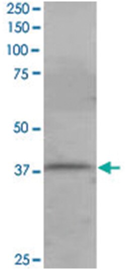 PSCDBP, Goat, Polyclonal Antibody, Abnova 100&mu;g; Unlabeled:Antibodies,