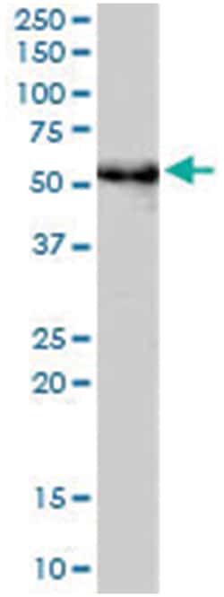 RP6-213H191, Goat, Polyclonal Antibody, Abnova 100 &mu;g | Buy Online | Abnova Corporation | Fisher Scientific