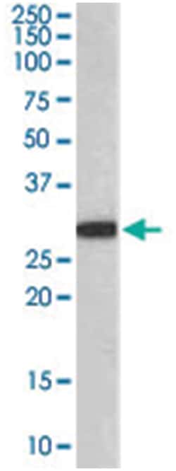 NQO1 Goat anti-Dog, Human, Mouse, Polyclonal Antibody, Abnova 100 &mu;g | Buy Online | Abnova Corporation | Fisher Scientific
