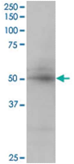 CREB3L4, Goat, Polyclonal Antibody, Abnova 100 &mu;g | Buy Online | Abnova Corporation | Fisher Scientific