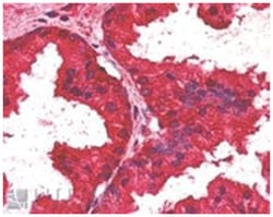 CREB3L4, Goat, Polyclonal Antibody, Abnova 100 &mu;g | Buy Online | Abnova Corporation | Fisher Scientific