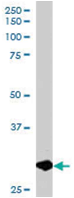 BCAP31, Goat, Polyclonal Antibody, Abnova 100 &mu;g | Buy Online | Abnova | Fisher Scientific