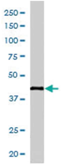 KLF3, Goat, Polyclonal Antibody, Abnova 100 &mu;g | Buy Online | Abnova Corporation | Fisher Scientific