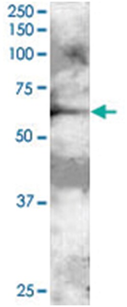 GRB7, Goat, Polyclonal Antibody, Abnova 100 &mu;g | Buy Online | Abnova Corporation | Fisher Scientific