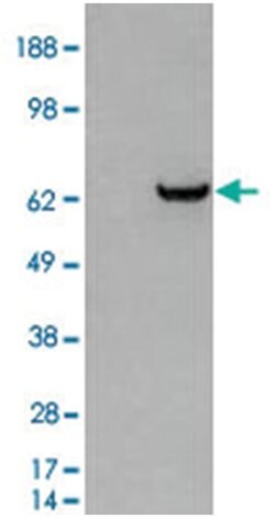 GRB7, Goat, Polyclonal Antibody, Abnova 100 &mu;g | Buy Online | Abnova Corporation | Fisher Scientific