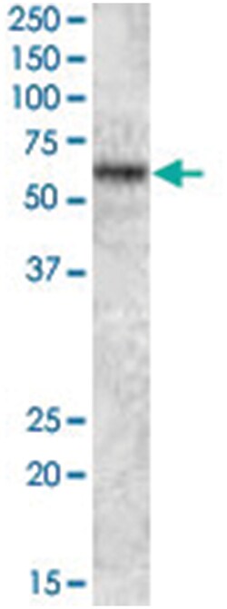 TFE3, Goat, Polyclonal Antibody, Abnova 100 &mu;g | Buy Online | Abnova Corporation | Fisher Scientific