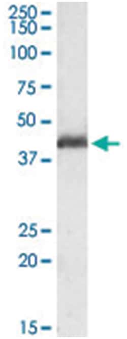 PAFAH1B1, Goat, Polyclonal Antibody, Abnova 100 &mu;g | Buy Online | Abnova Corporation | Fisher Scientific