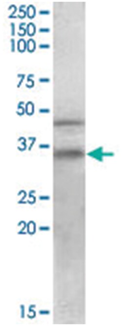 GULP1, Goat, Polyclonal Antibody, Abnova 100 &mu;g | Buy Online | Abnova | Fisher Scientific