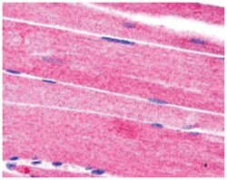 SORBS1 Goat anti-Human, Polyclonal Antibody, Abnova 100 &mu;g | Buy Online | Abnova Corporation | Fisher Scientific