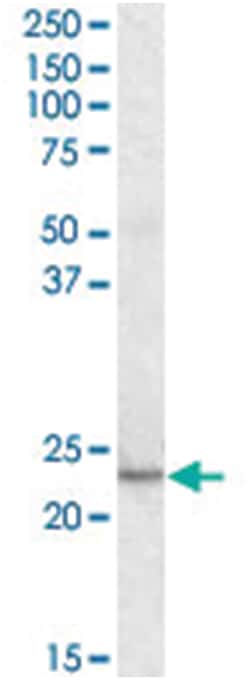 KLF16, Goat, Polyclonal Antibody, Abnova 100&mu;g; Unlabeled:Antibodies,
