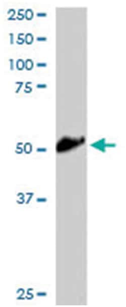 KLF8, Goat, Polyclonal Antibody, Abnova 100 &mu;g | Buy Online | Abnova Corporation | Fisher Scientific