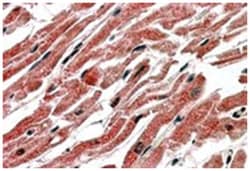 CPT1B, Goat, Polyclonal Antibody, Abnova 100 &mu;g | Buy Online | Abnova Corporation | Fisher Scientific
