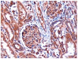 KIF5B, Goat, Polyclonal Antibody, Abnova 100 &mu;g | Buy Online | Abnova Corporation | Fisher Scientific