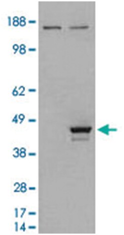 ELF3, Goat, Polyclonal Antibody, Abnova 100 &mu;g | Buy Online | Abnova Corporation | Fisher Scientific