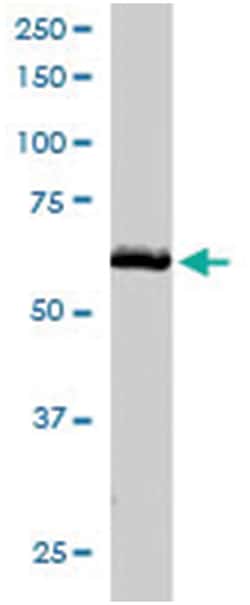 TXNRD1, Goat, Polyclonal Antibody, Abnova 100 &mu;g | Buy Online | Abnova Corporation | Fisher Scientific