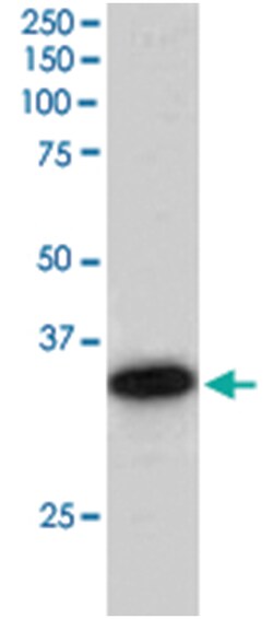 CBR1, Goat, Polyclonal Antibody, Abnova 100 &mu;g | Buy Online | Abnova Corporation | Fisher Scientific