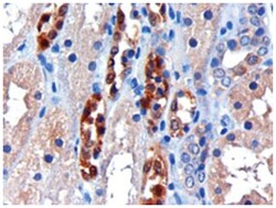 CBR1, Goat, Polyclonal Antibody, Abnova 100 &mu;g | Buy Online | Abnova Corporation | Fisher Scientific