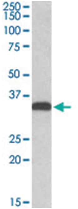 CBR3, Goat, Polyclonal Antibody, Abnova 100 &mu;g | Buy Online | Abnova Corporation | Fisher Scientific