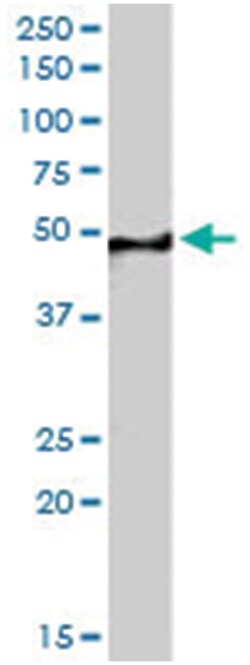 SF3B4, Goat, Polyclonal Antibody, Abnova 100 &mu;g | Buy Online | Abnova Corporation | Fisher Scientific