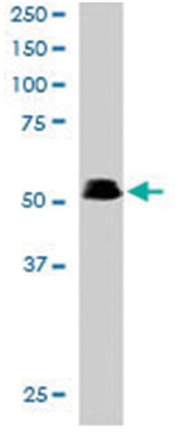 PAX5, Goat, Polyclonal Antibody, Abnova 100 &mu;g | Buy Online | Abnova Corporation | Fisher Scientific