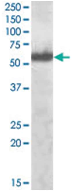 IRF5, Goat, Polyclonal Antibody, Abnova 100 &mu;g | Buy Online | Abnova | Fisher Scientific