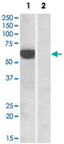 IRF5, Goat, Polyclonal Antibody, Abnova 100 &mu;g | Buy Online | Abnova | Fisher Scientific