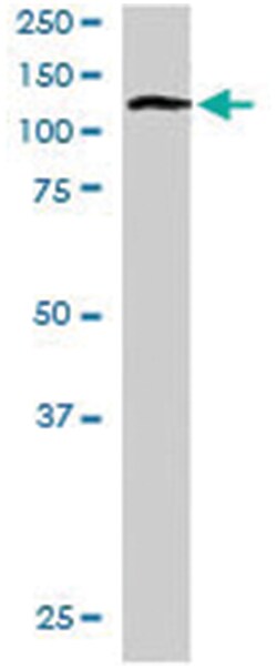 RNF31, Goat, Polyclonal Antibody, Abnova 100 &mu;g | Buy Online | Abnova Corporation | Fisher Scientific