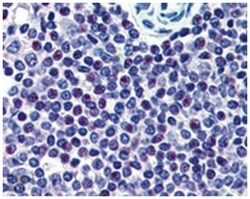 HMG20A, Goat, Polyclonal Antibody, Abnova 100&mu;g; Unlabeled:Antibodies,