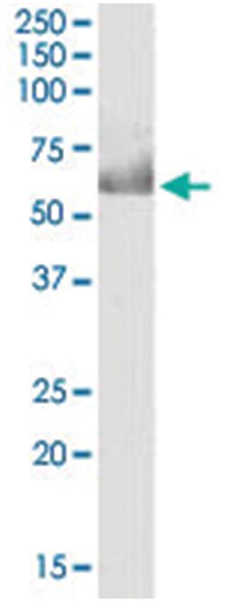 CDT1, Goat, Polyclonal Antibody, Abnova 100 &mu;g | Buy Online | Abnova Corporation | Fisher Scientific