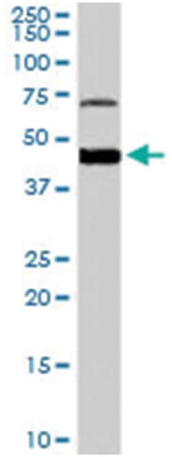 FOXG1, Goat, Polyclonal Antibody, Abnova 100&mu;g; Unlabeled:Antibodies,