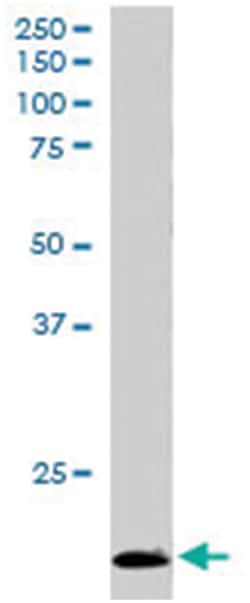 TBPL1, Goat, Polyclonal Antibody, Abnova 100 &mu;g | Buy Online | Abnova Corporation | Fisher Scientific