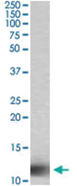 RPS27, Goat, Polyclonal Antibody, Abnova 100 &mu;g | Buy Online | Abnova Corporation | Fisher Scientific
