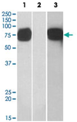 GOLM1, Goat, Polyclonal Antibody, Abnova 100 &mu;g | Buy Online | Abnova Corporation | Fisher Scientific