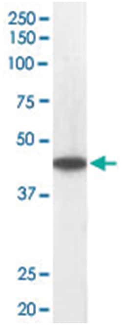 ACADM, Goat, Polyclonal Antibody, Abnova 100 &mu;g | Buy Online | Abnova Corporation | Fisher Scientific