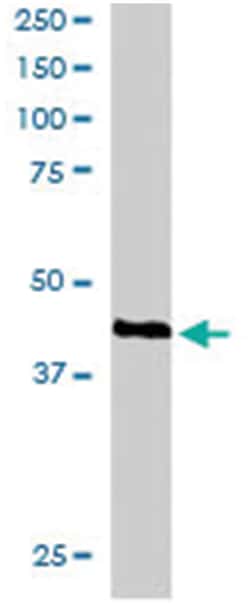 RAD51C, Goat, Polyclonal Antibody, Abnova 100 &mu;g | Buy Online | Abnova Corporation | Fisher Scientific