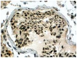 RAD51AP1, Goat, Polyclonal Antibody, Abnova 100 &mu;g | Buy Online | Abnova Corporation | Fisher Scientific