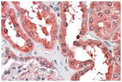 AS3MT, Goat, Polyclonal Antibody, Abnova 100 &mu;g | Buy Online | Abnova Corporation | Fisher Scientific