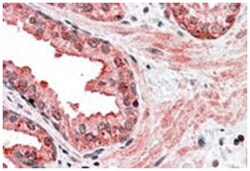 CCNDBP1, Goat, Polyclonal Antibody, Abnova 100 &mu;g | Buy Online | Abnova | Fisher Scientific