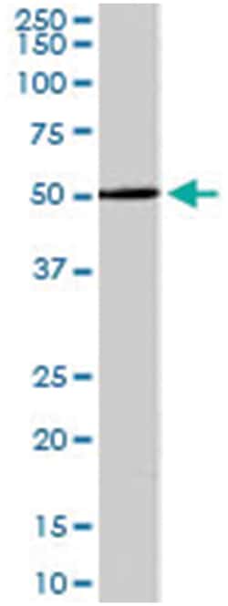 PRDM11, Goat, Polyclonal Antibody, Abnova 100 &mu;g | Buy Online | Abnova Corporation | Fisher Scientific