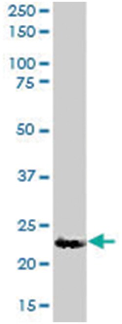 UBE2K, Goat, Polyclonal Antibody, Abnova 100&mu;g; Unlabeled:Antibodies,
