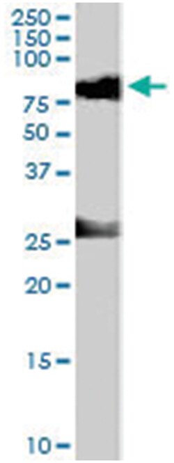 CDYL, Goat, Polyclonal Antibody, Abnova 100 &mu;g | Buy Online | Abnova Corporation | Fisher Scientific